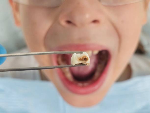Best Emergency Dental Services for Seniors in Newk, AR